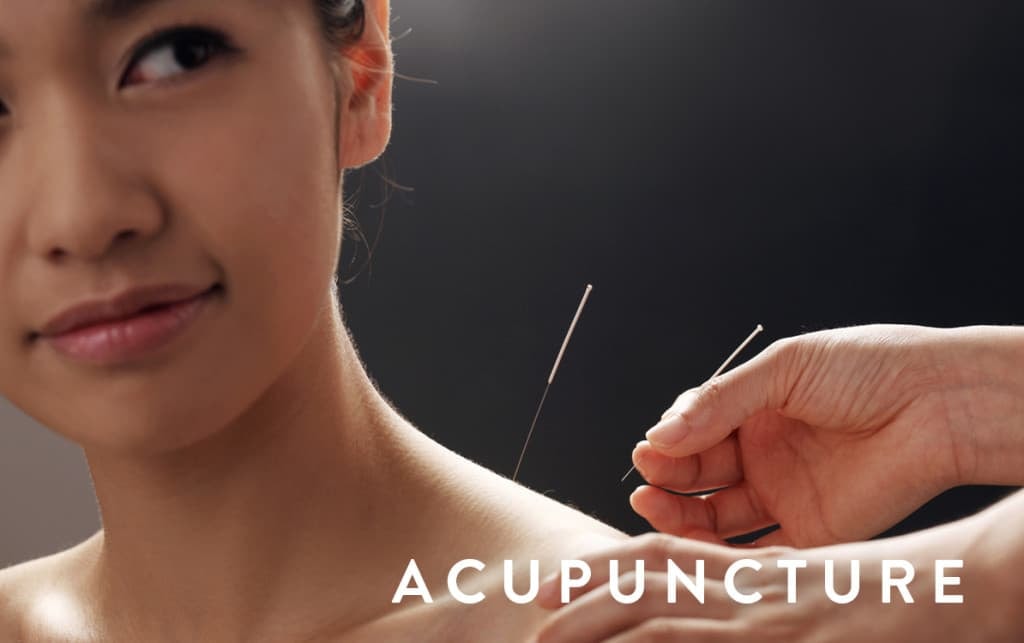 Acupuncture treatment in progress